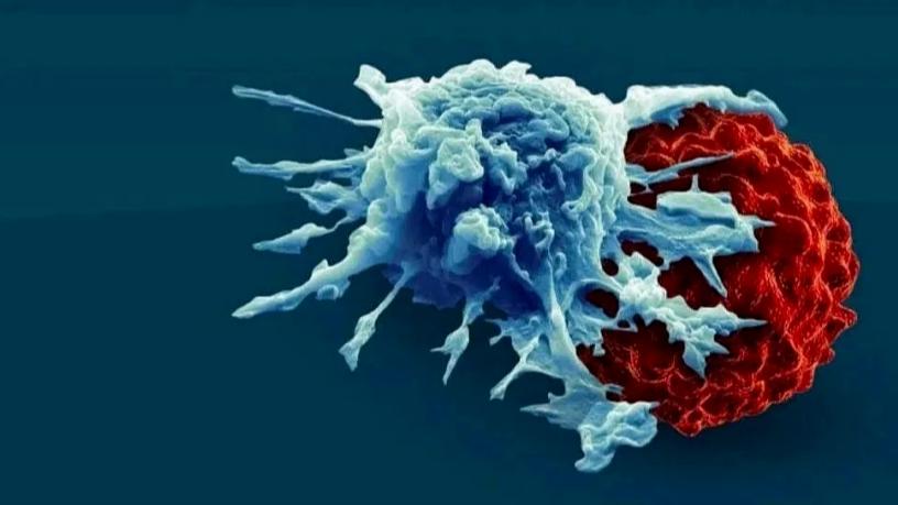 临床进展丨在癌症治疗中探索NK细胞免疫疗法