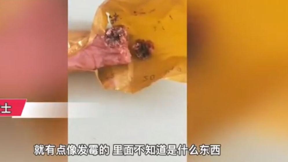 吃火腿肠发现黑霉斑，女子找到商家反映，商家：不属于质量问题