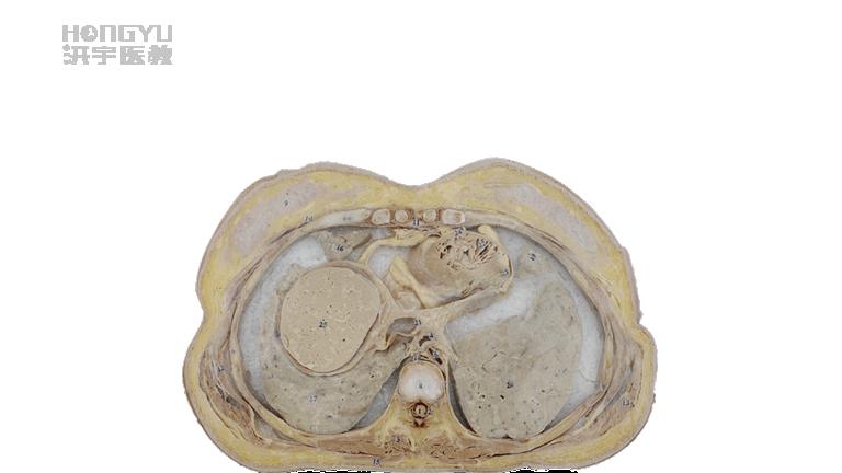 人体断层标本的制作过程有哪些？