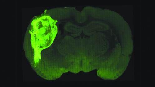 美科学家最新研究，将人类“迷你大脑”成功植入老鼠体内