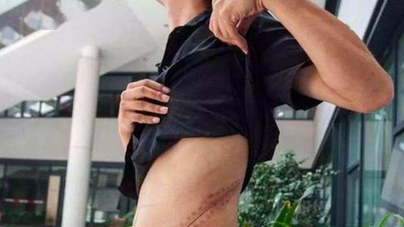 华为|年轻人不买手机、却迷上买手机壳，背后原因是什么？