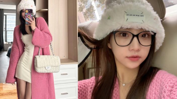 王思聪|?慎婕被烫伤，皮肤红润，真的很心疼