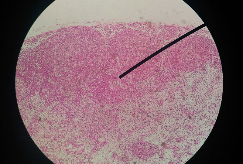 枸杞|hpv若要清零,常吃这“ 一黄”,坚持12个月,子宫更强大