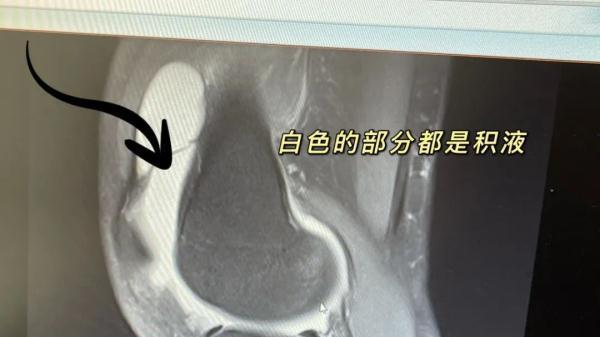 闯祸了：一位23岁的杭州姑娘裤子太短……被送进了医院！活该吗？