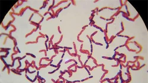 科学家为永生，和女模特一起注射350万年前细菌，2年后意外发生了