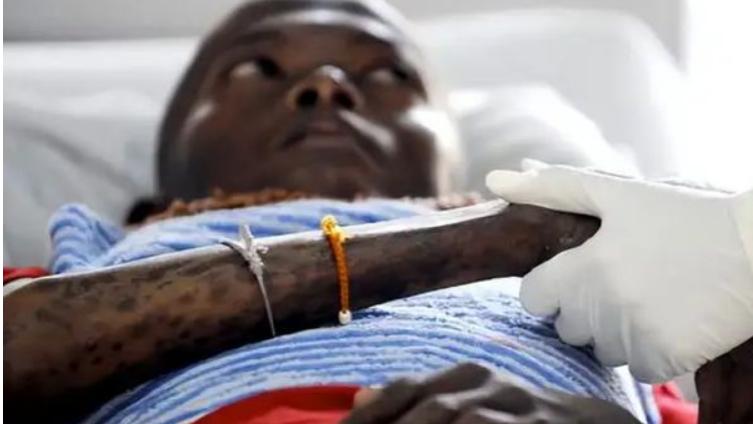 非洲“艾滋之国”：平均寿命仅35岁，国王为防艾滋传染措施太奇葩