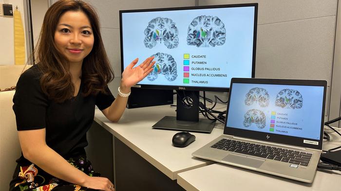 科学家们已经找出精神病人和正常人之间的关键生物学差异