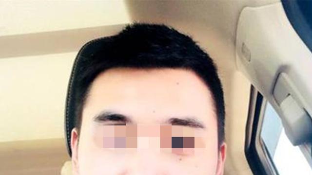 整容|案例：女模特花50万整容成网红脸，遭富豪嫌弃酿悲剧