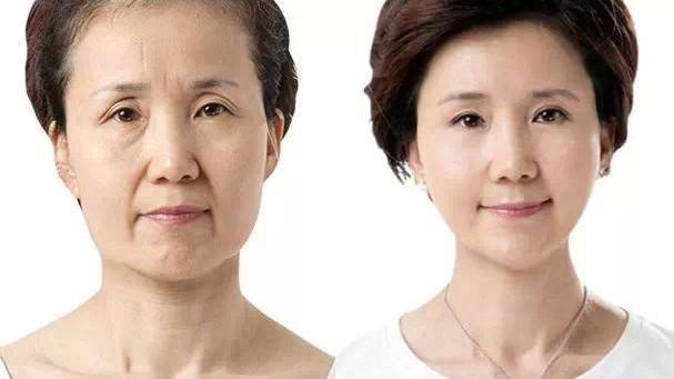 温碧霞|长期使用精华的皮肤，三年后会变成什么样子？说出来你都不敢相信