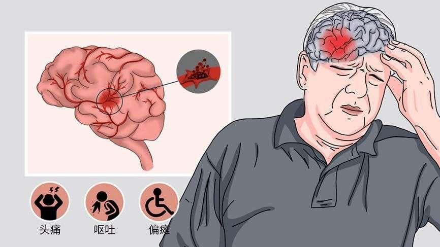 党嫂透露大娘脑出血处于半昏迷，网友希望她不能有事要坚持到最后