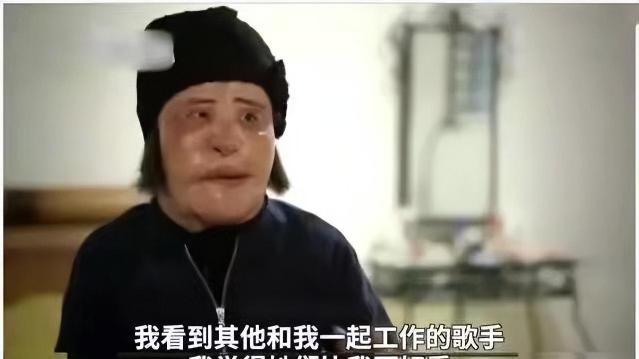 小姐姐|“整容上瘾”韩慧景：自行注射大豆油把脸整成电风扇，代价惨痛