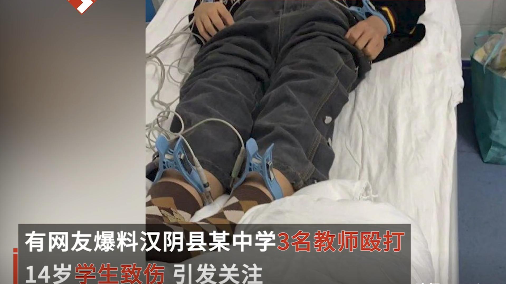 陕西安康3名体育老师操场围殴14岁学生，学生放学回家家长发现伤势，讨要说法却反被指责？
