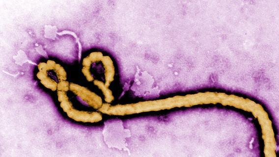 感染性更强，致死性超高，美科学家制造出新病毒奥密克戎S