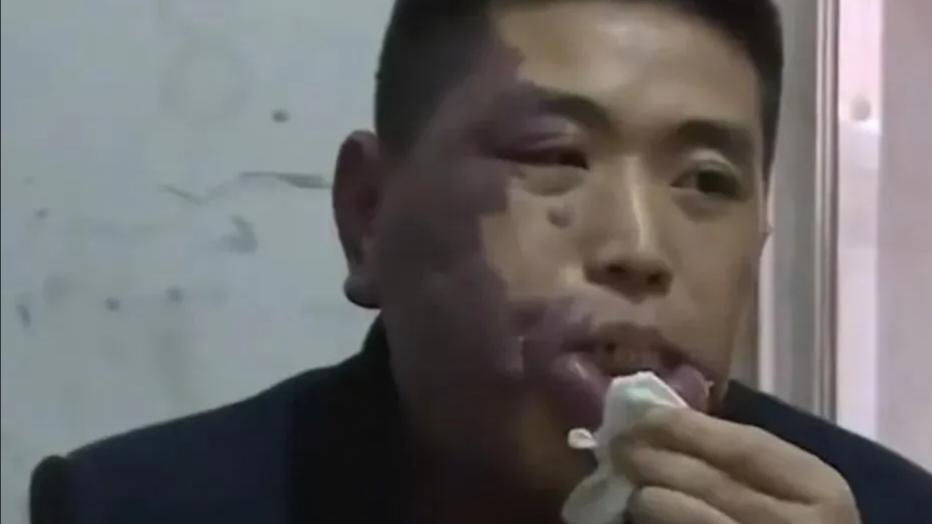 姐姐|31岁男子因长得难看找工作屡次被拒，姐姐因为他还离婚了。为减少家人负担，男子在外