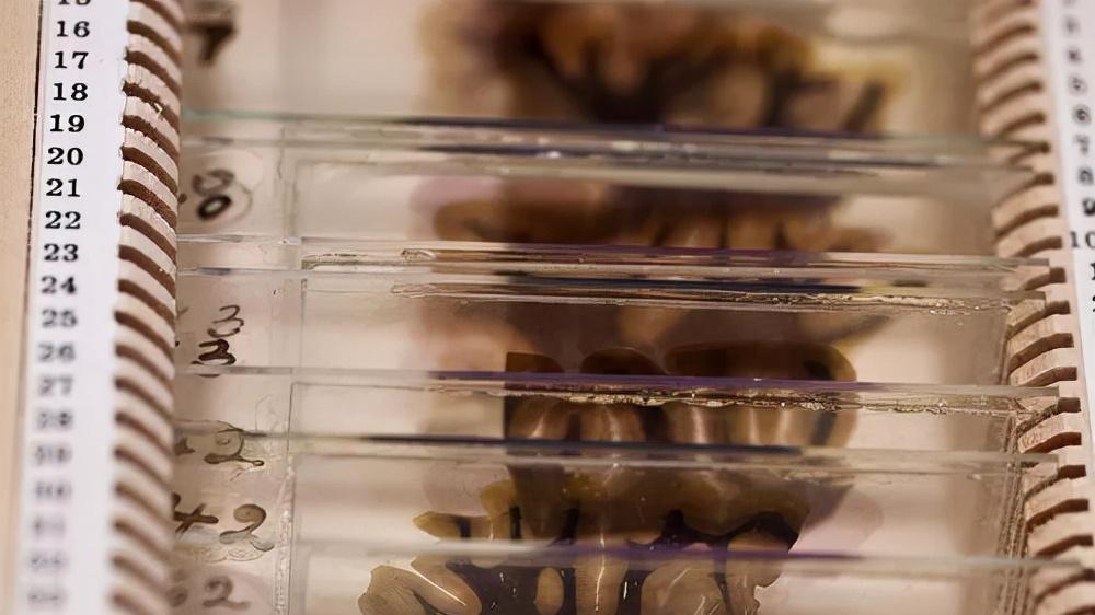 爱因斯坦的大脑、人类最大便便……看了这座博物馆，我大开眼界