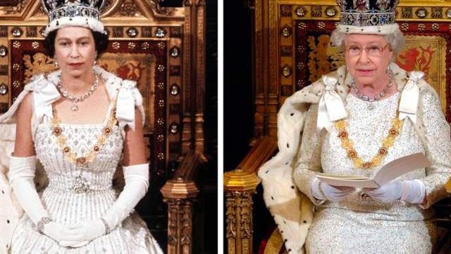 |伊丽莎白女王驾崩，曾24小时佩戴医疗手环，手部发黑青筋暴起