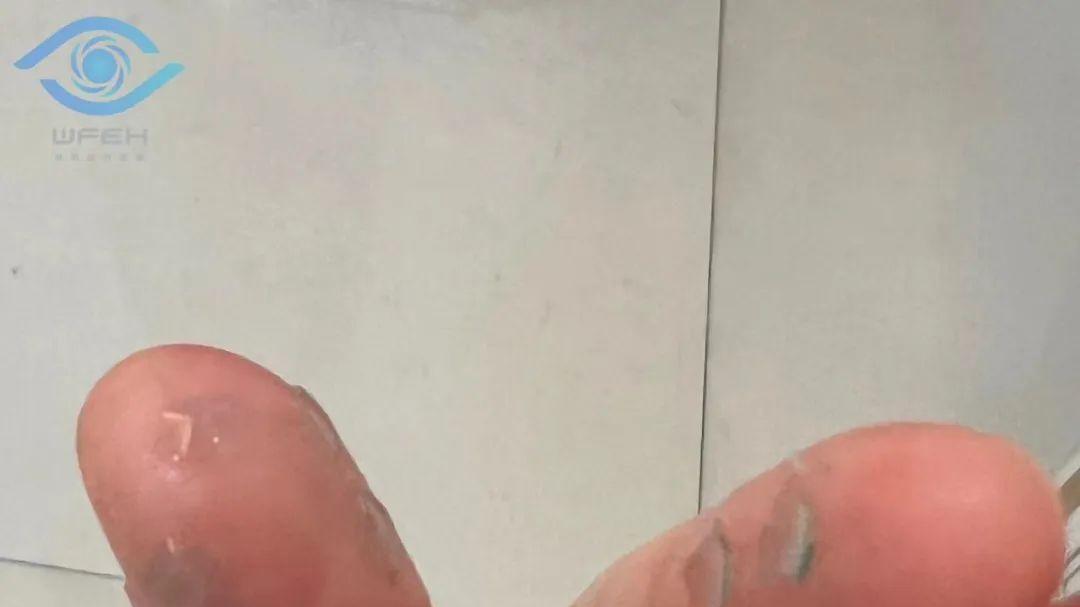 气温骤降，角膜塑形镜应该如何保暖？
