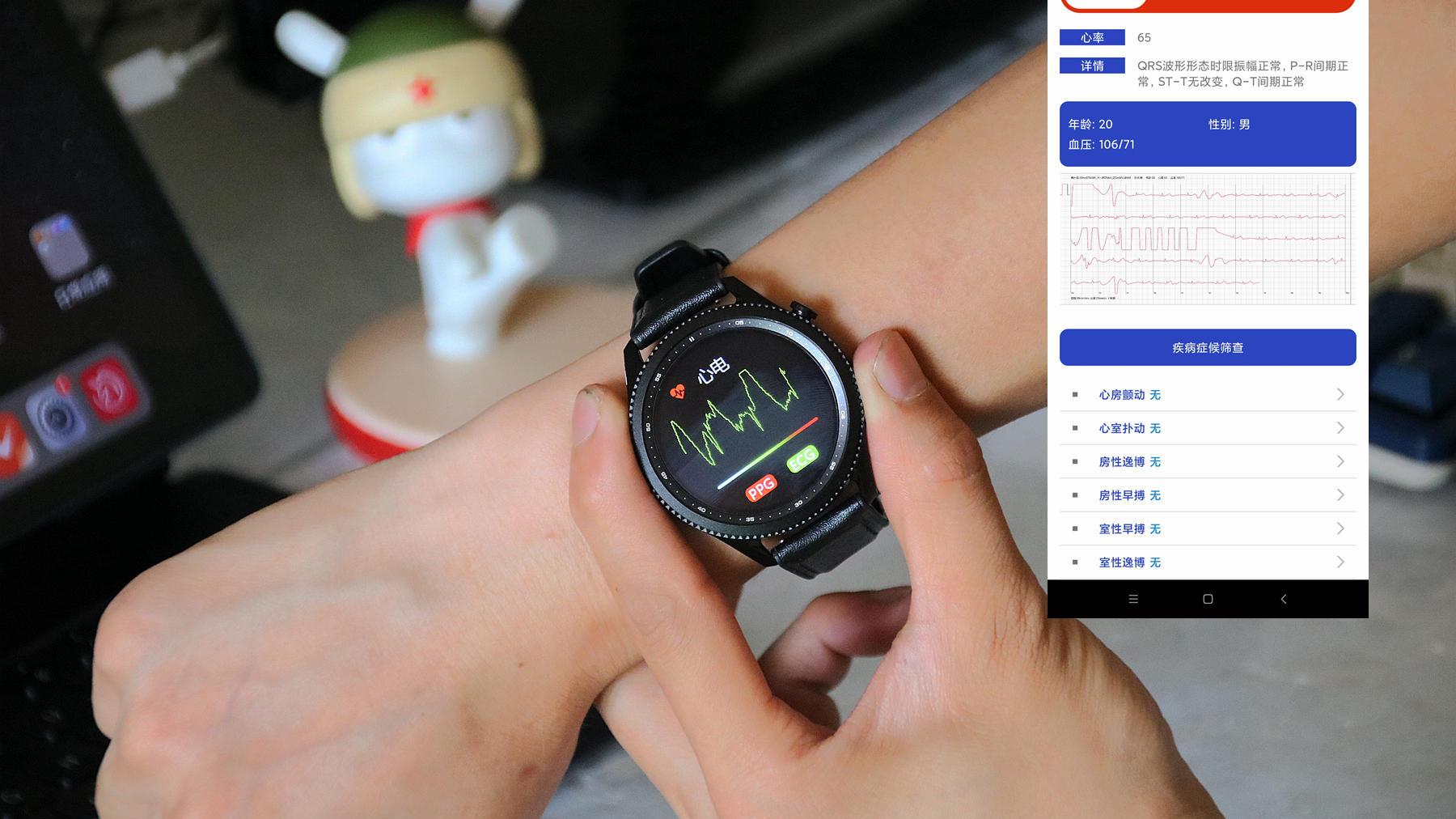|你能想到的健康监测功能它都有，dido E10血压心电智能手表体验