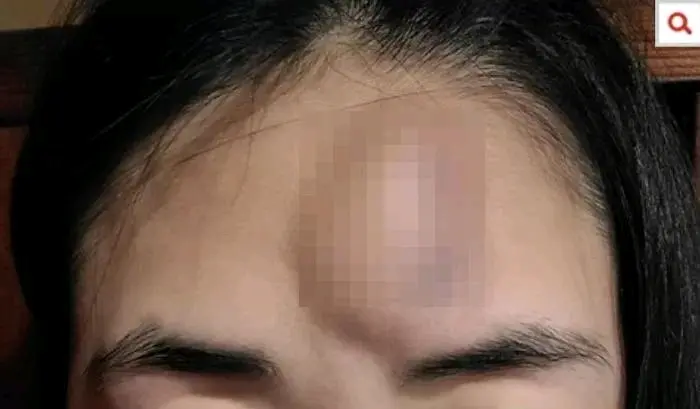 韩国女子因为约会没有AA制被揍进医院，韩国30%女性都遭受过暴力