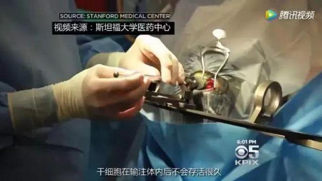 30 岁后每十年一道坎儿，干细胞技术帮你征服人生每一道病坎！