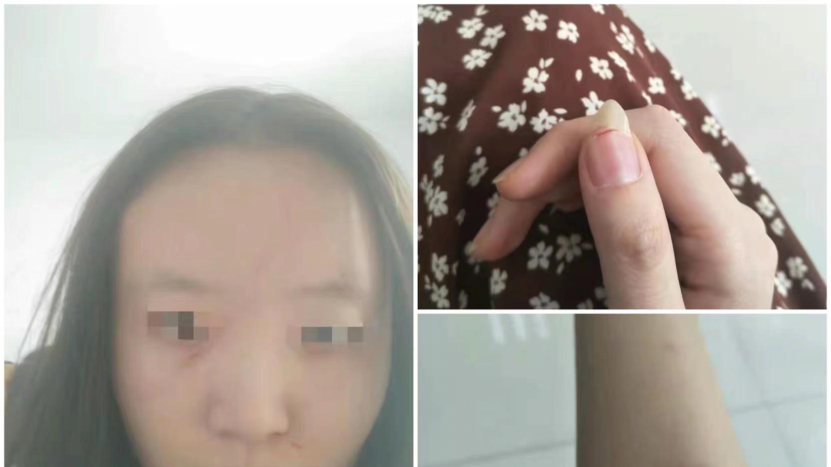 山东淄博女生被室友打，两人闹上公堂，室友比剧本还离奇！