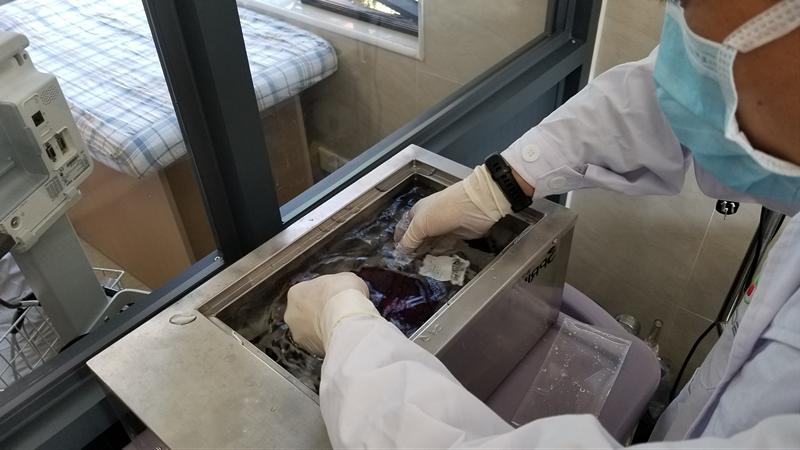 脐带血造血干细胞成骨髓增生异常综合征克星！助力4岁女童重获新生