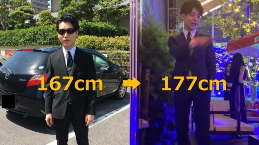 2014年，20岁李亚诺花16万断骨，只为长高7.2厘米，如今后悔不迭
