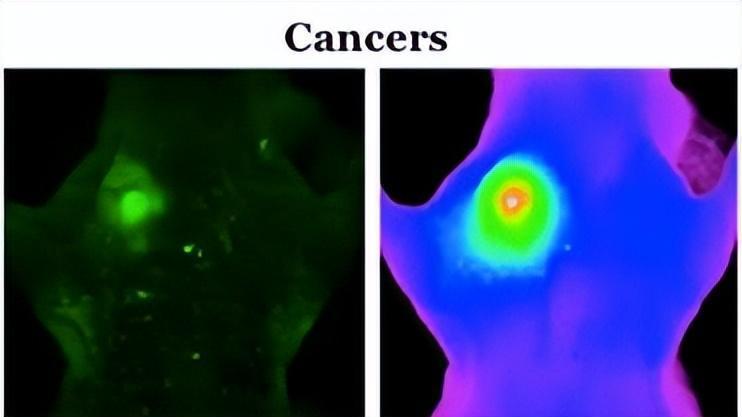 新研究：靶向免疫疗法相结合，或可彻底消除癌症细胞，速来了解
