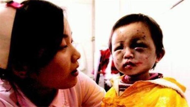 青海小苏丽：3岁被针线缝嘴5岁被虐死，母亲出狱后将其挫骨扬灰