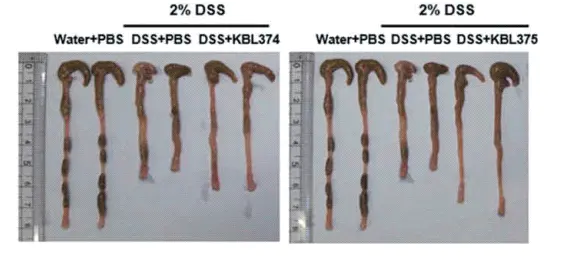 dss溃疡性结肠炎小鼠模型构建 dss诱导大鼠肠炎模型的建立