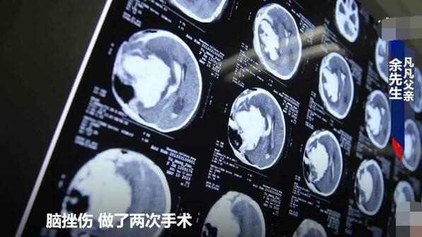 女孩不慎将苹果丢出窗外，楼下1岁的女童被砸残疾，终生不能行动