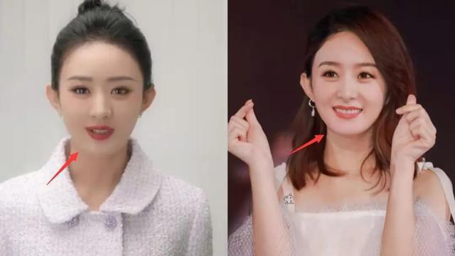 杨紫|2瓜！曝赵丽颖整容失败近照像蜡人，杨紫鼻孔不对称面肿像机器人！