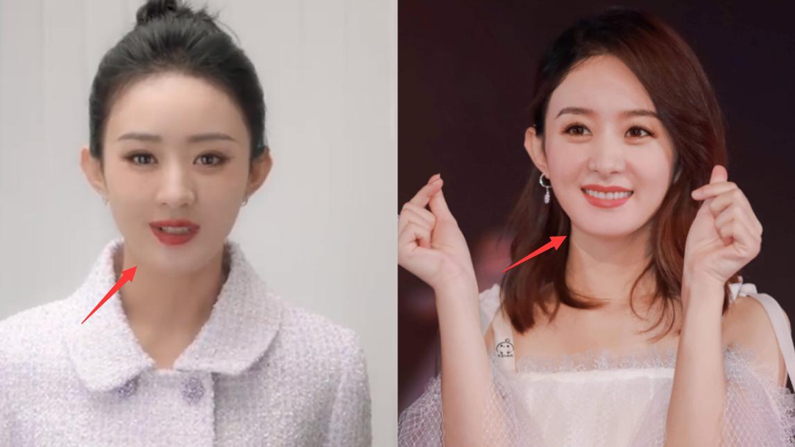 赵丽颖|赵丽颖近照变化大，脸肿僵硬像蜡人，圆脸变成长脸被指整容失败
