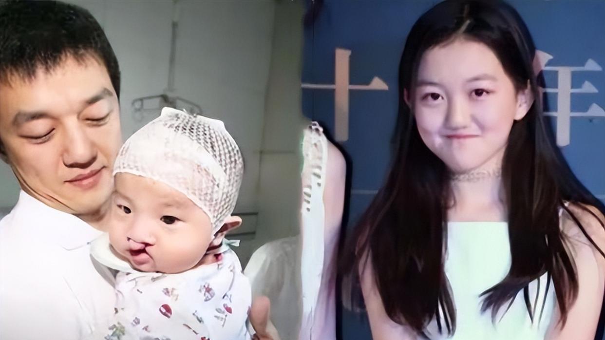 李亚鹏|命真苦！李亚鹏小女疑患基因病，手脱皮指甲异常，妻子身体引担忧