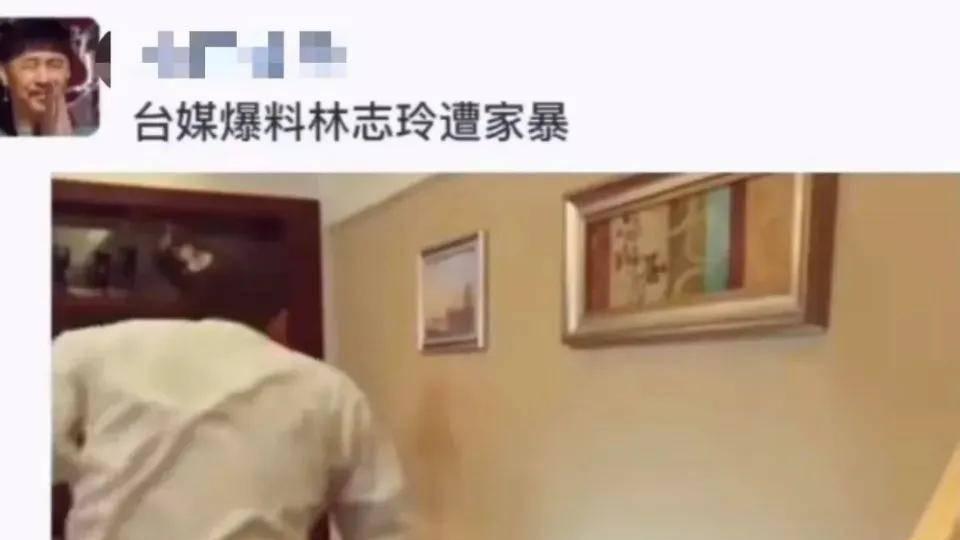 林志玲|半夜瓜！网传林志玲遭家暴照片，假体被打出，日籍老公多次出轨