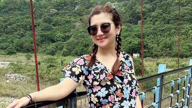 Selina挺孕肚拍大片，晒手臂疤痕惹人心疼，因烧伤孕期水肿严重