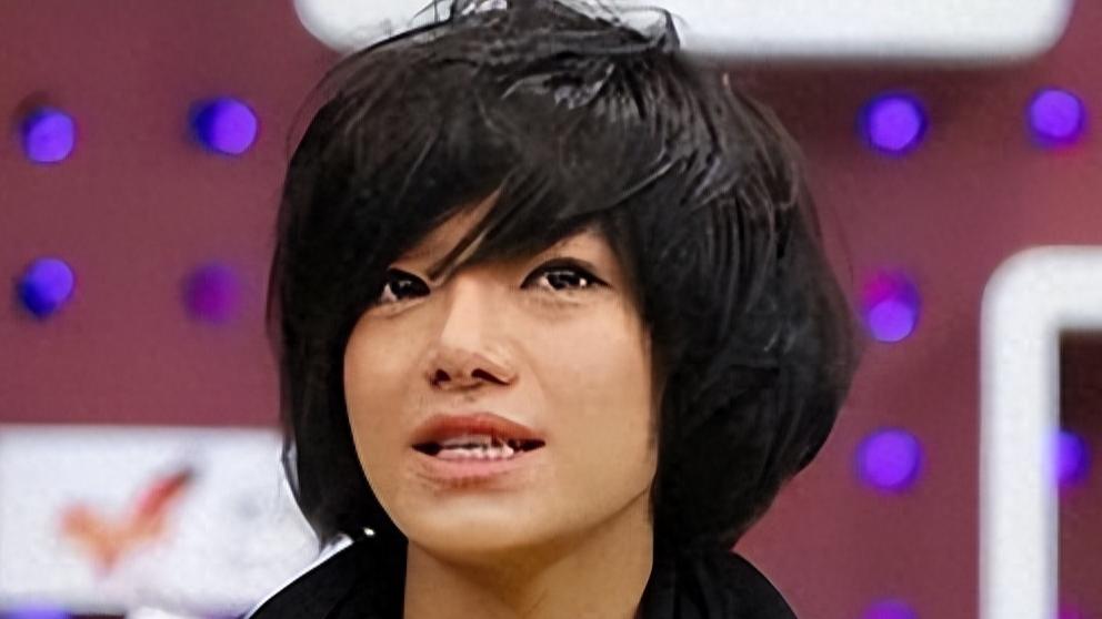 超女冠军江映蓉：因整容失败像“怪物”，全身只剩眼珠是自己的