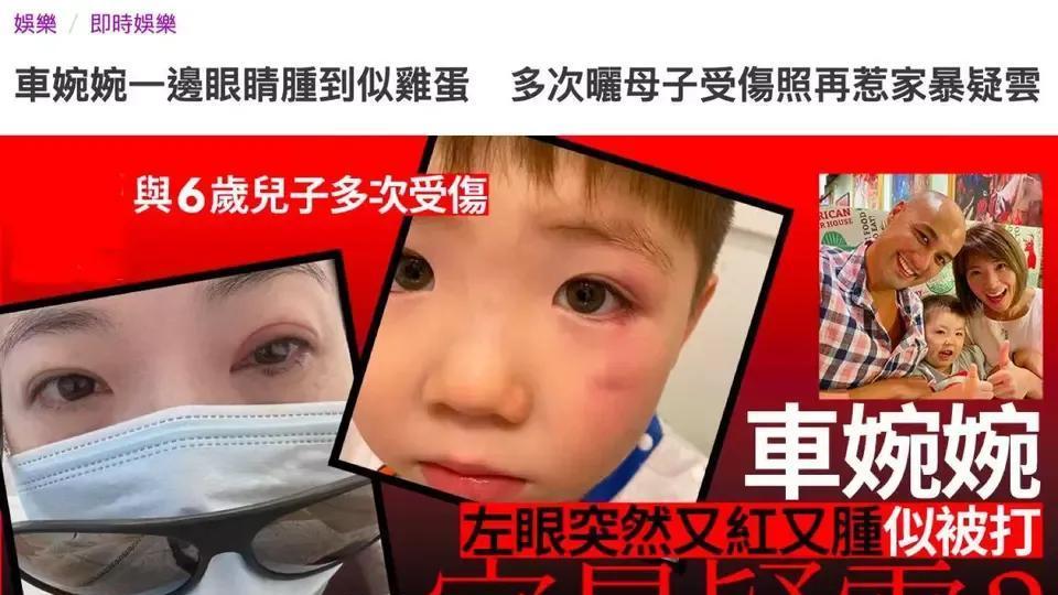 车婉婉|突发！陈小春前女友疑被家暴，曾多次晒自己与6岁儿子面部受伤照