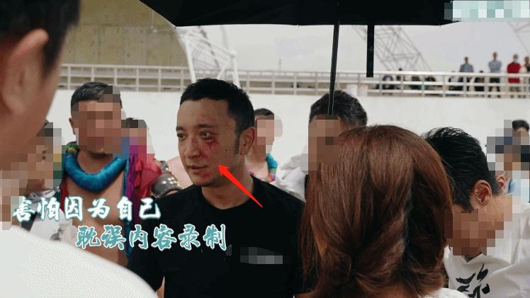 尼格买提·热合曼|尼格买提录节目突发意外！用脸刹车血痕遍布，撒贝宁举动引争议