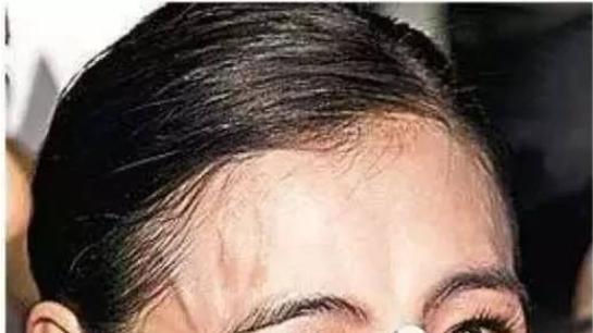 43岁张柏芝不幸病倒！紧急停止所有工作，经过积极治疗仍未好转