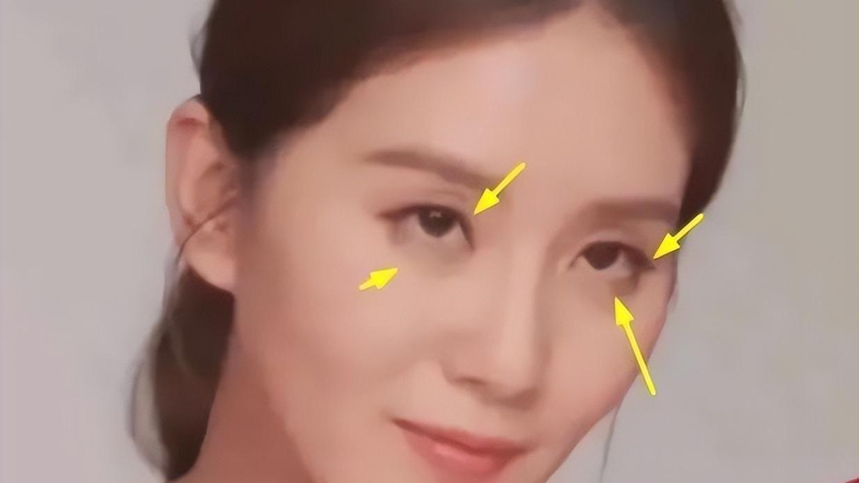 36岁刘诗诗终现原形，眼窝凹陷褶皱明显，原是与吴奇隆争抢养权？