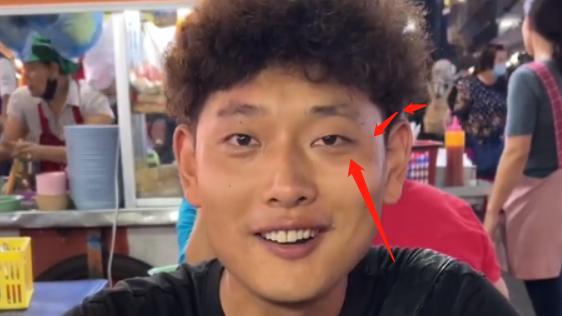 曝知名网红在缅甸被控制！鼻青脸肿脚旁蹲人，举止反常邀粉丝前往