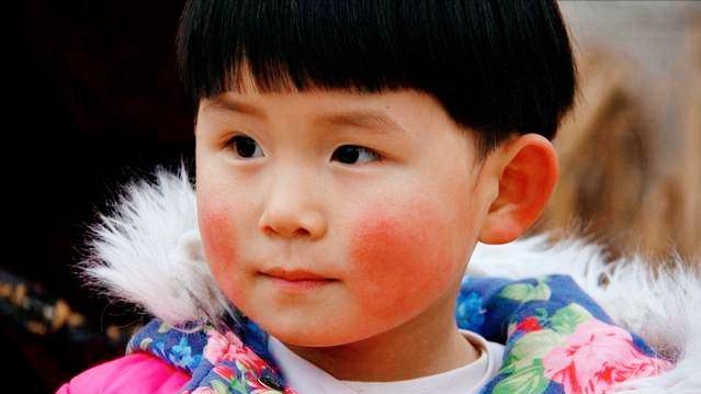 育儿知识 冬季给宝宝护肤：注意几个“小心机”，让你家娃远离皮肤问题
