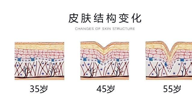 护肤干货 l 抗皱也要分龄？50+尤其要注意！