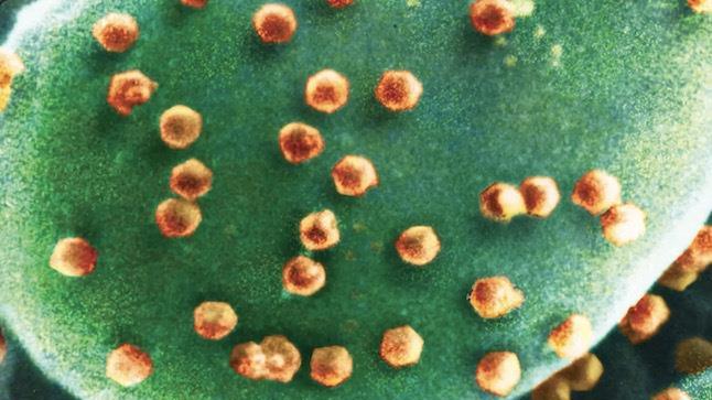 科学家发现能吃掉并消化病毒的微生物！病毒的终极天敌要来了？