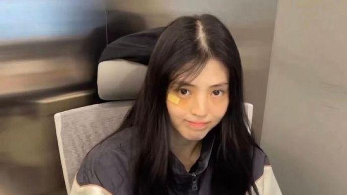 韩素希近照发缝超宽像是秃了一大块，眼神中的破碎感难掩让人心碎