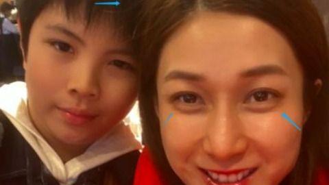 39岁钟嘉欣加拿大街头被偶遇，生图曝真实状态，断发严重脸不对称