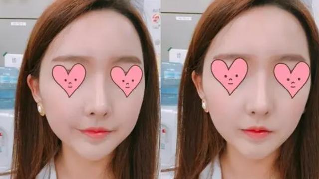 “套路太深了”！女大学生入职却被怂恿整容，公司却一问三不知