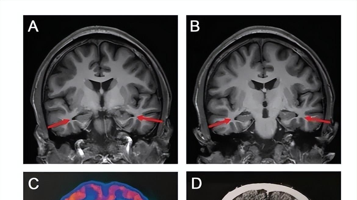 界面设计|高通宣布继续向华为供货，中国石化投资设立智能机器人公司