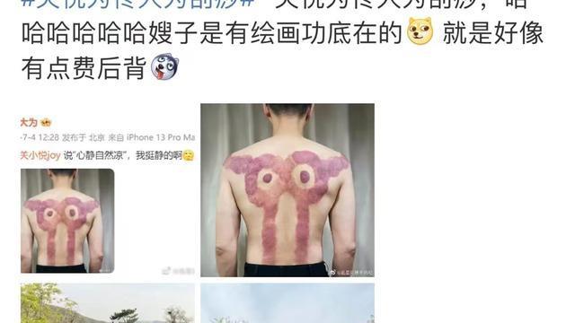 晒出关悦为自己刮痧照片乐翻网友佟大为深夜现身剧组拍戏